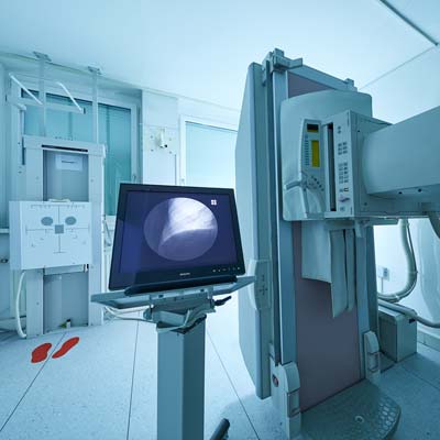 Digitales-Lungenröntgen